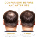 EELHOE Rosemary Hair Treatment Oil Scalp Cleansing Conditioning Volumizing Smoothing Repair Dry Frizzy Hair Conditioning Hair Treatment Oil - Image 5